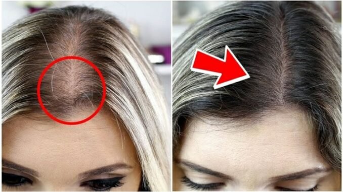 Shampoo caseiro para acabar com a queda de cabelo