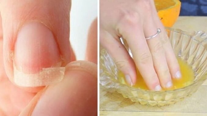 Tenha UNHAS GRANDES e FORTES com essa Receita Caseira